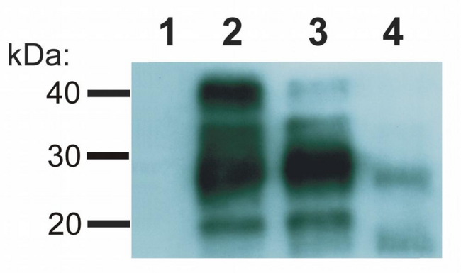 PRNP / PrP / Prion Antibody - Western blotting analysis of Creutzfeld-Jakob disease (CJD) negative (lane 1, 2) and CJD positive (lane 3, 4) human brain material using anti-PrP antibody (clone EM-20). CJD positive patient has proteinase K resistent prion protein.  Lane 1, 4: Samples with proteinase K treatment  Lane 2, 3: Samples without proteinase K treatment
