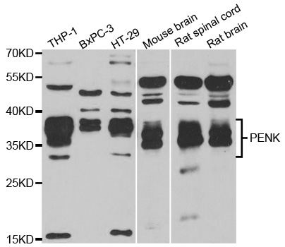 Proenkephalin / PENK Antibody - Western blot analysis of extracts of various cell lines.
