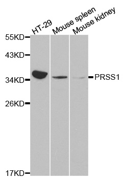PRSS1 / Trypsin Antibody - Western blot analysis of extracts of various cell lines, using PRSS1 antibody at 1:1000 dilution. The secondary antibody used was an HRP Goat Anti-Rabbit IgG (H+L) at 1:10000 dilution. Lysates were loaded 25ug per lane and 3% nonfat dry milk in TBST was used for blocking.