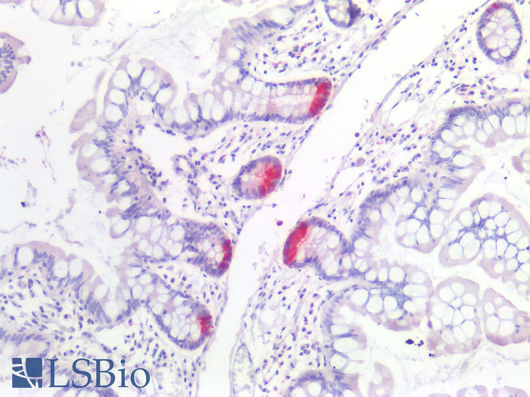 PRSS1 / Trypsin Antibody - Human Small Intestine Paneth Cells: Formalin-Fixed, Paraffin-Embedded (FFPE)