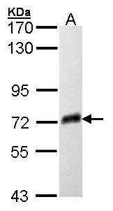 PSAP / Prosaposin Antibody - Sample (30 ug of whole cell lysate). A: Molt-4 . 7.5% SDS PAGE. Prosaposin antibody diluted at 1:2000.