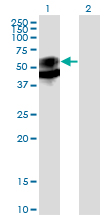 PSAP / Prosaposin Antibody - Western blot of PSAP expression in transfected 293T cell line by PSAP monoclonal antibody clone 1D1-C12.