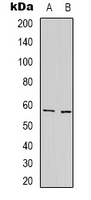 PSAP / Prosaposin Antibody - Western blot analysis of Prosaposin expression in HepG2 (A); NIH3T3 (B) whole cell lysates.