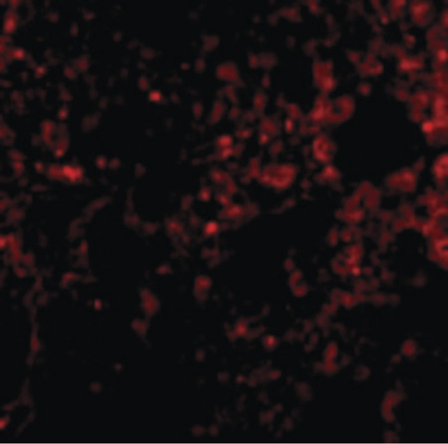 PSENEN / PEN-2 Antibody - Immunofluorescence of PEN2 in Rat Lung cells with PEN2 antibody at 20 ug/ml.