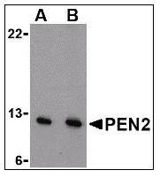 PSENEN / PEN-2 Antibody - Western blot of PEN2 in A-20 cell lysate with PSENEN / PEN-2 Antibody at (A) 0.5 and (B) 1 ug/ml.