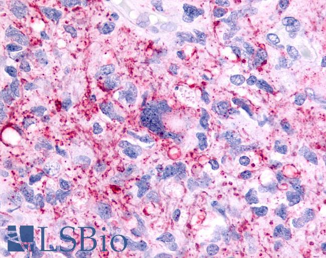PTGER1 / EP1 Antibody - Brain, Glioblastoma