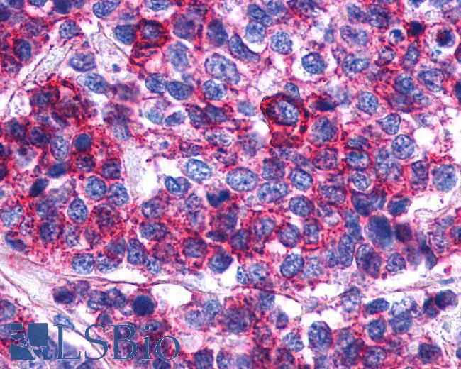 PTGER2 / EP2 Antibody - Lung, Small Cell Carcinoma