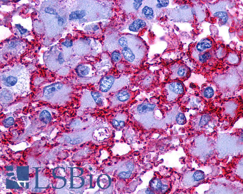 PTGER2 / EP2 Antibody - Brain, Glioblastoma