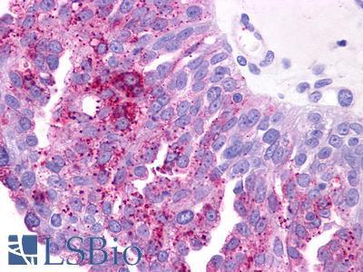 PTGER3 / EP3 Antibody - Ovary, carcinoma