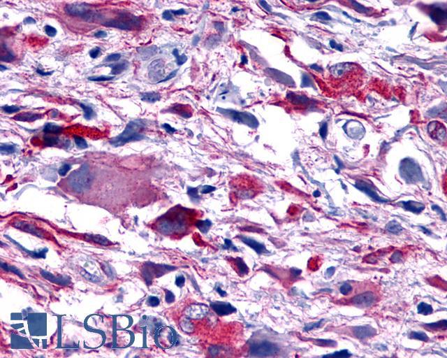 PTGER4 / EP4 Antibody - Brain, Glioblastoma
