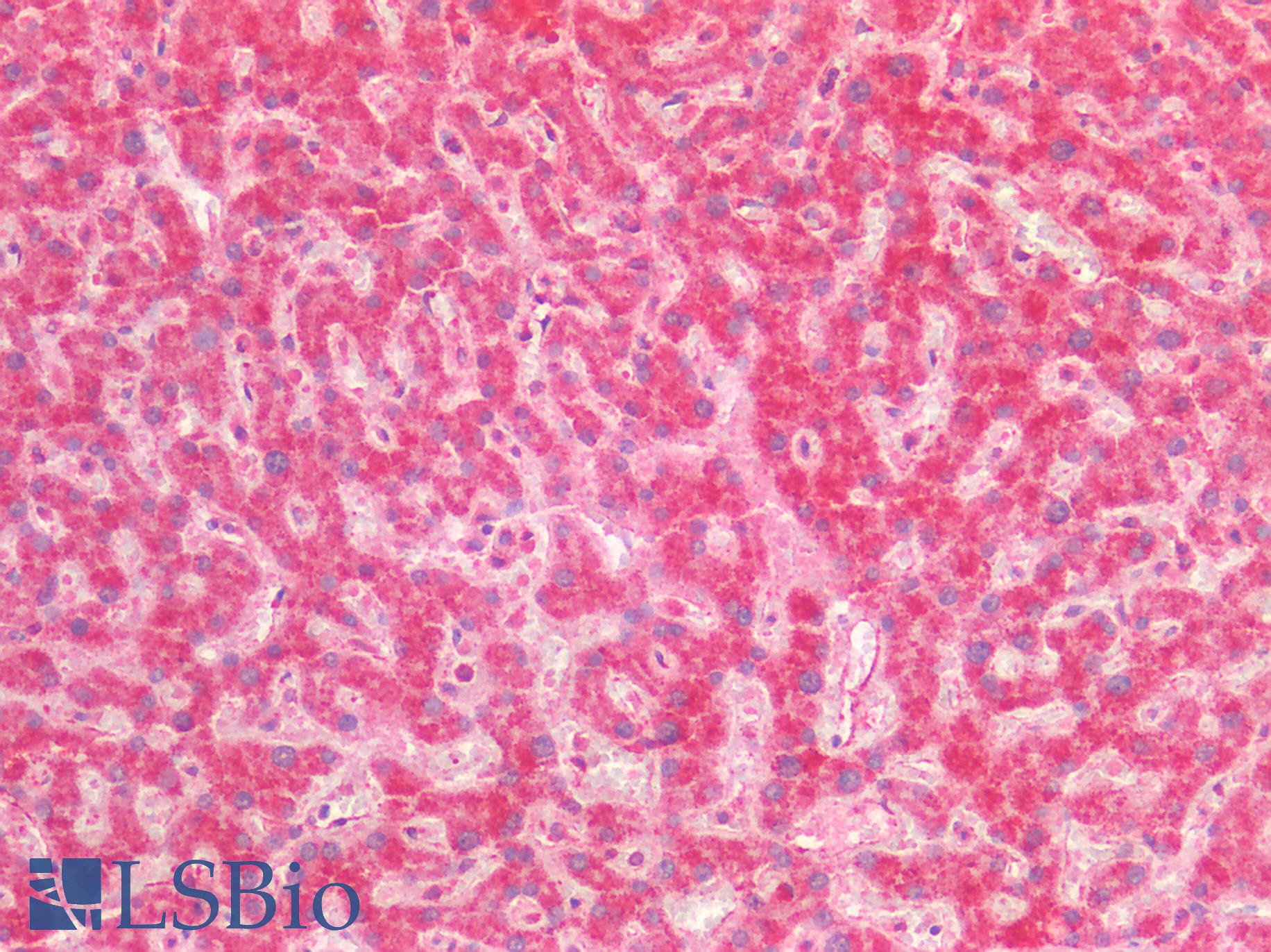 PTGS2 / COX2 / COX-2 Antibody - Human Liver: Formalin-Fixed, Paraffin-Embedded (FFPE)