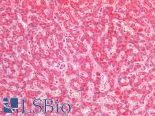 PTGS2 / COX2 / COX-2 Antibody - Human Liver: Formalin-Fixed, Paraffin-Embedded (FFPE)