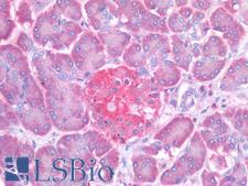 PTP1B Antibody - Human Pancreas, Islet of Langerhans: Formalin-Fixed, Paraffin-Embedded (FFPE)