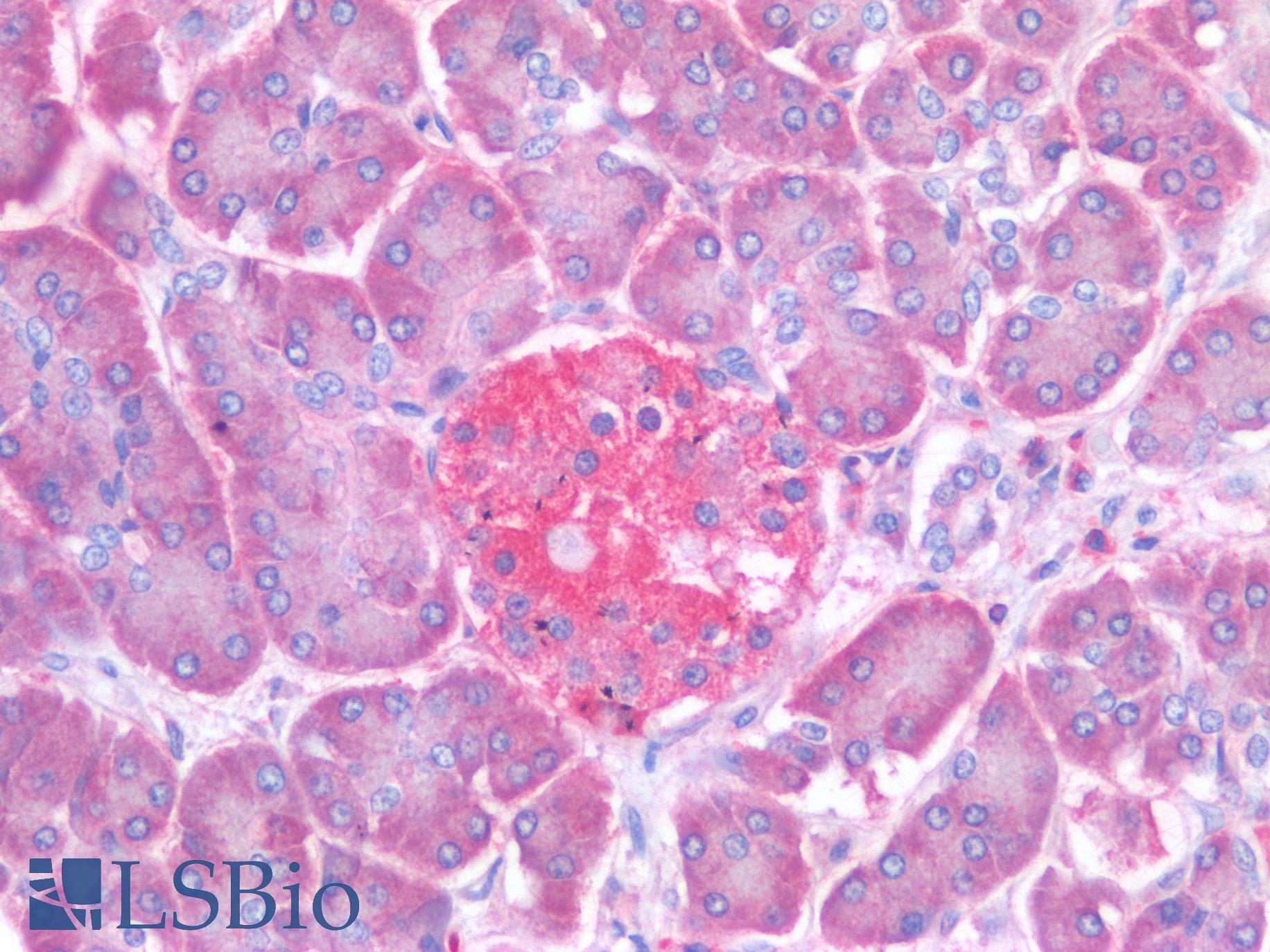 PTP1B Antibody - Human Pancreas, Islet of Langerhans: Formalin-Fixed, Paraffin-Embedded (FFPE)