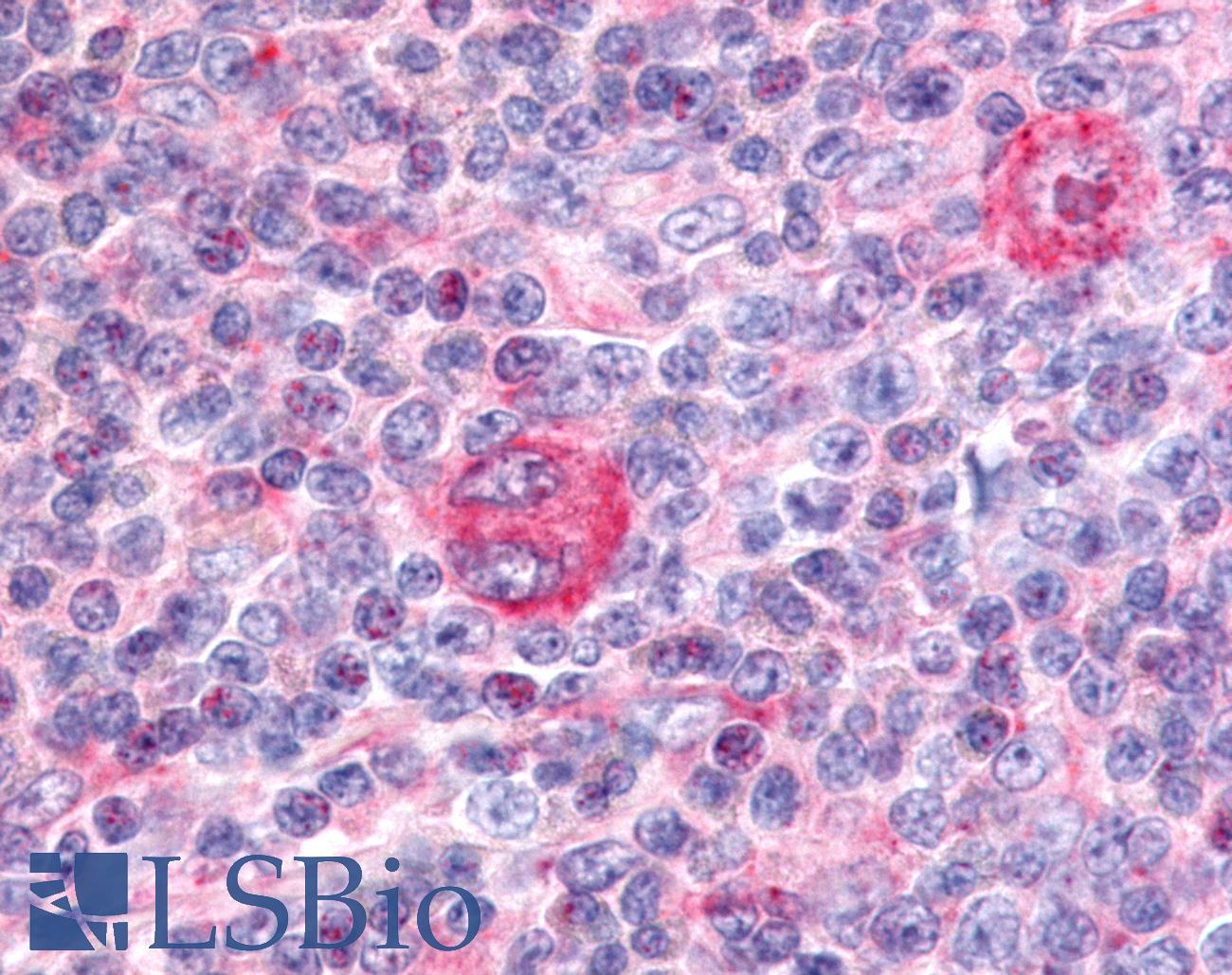 PTPRE / PTP Epsilon Antibody - Hodgkin's lymphoma