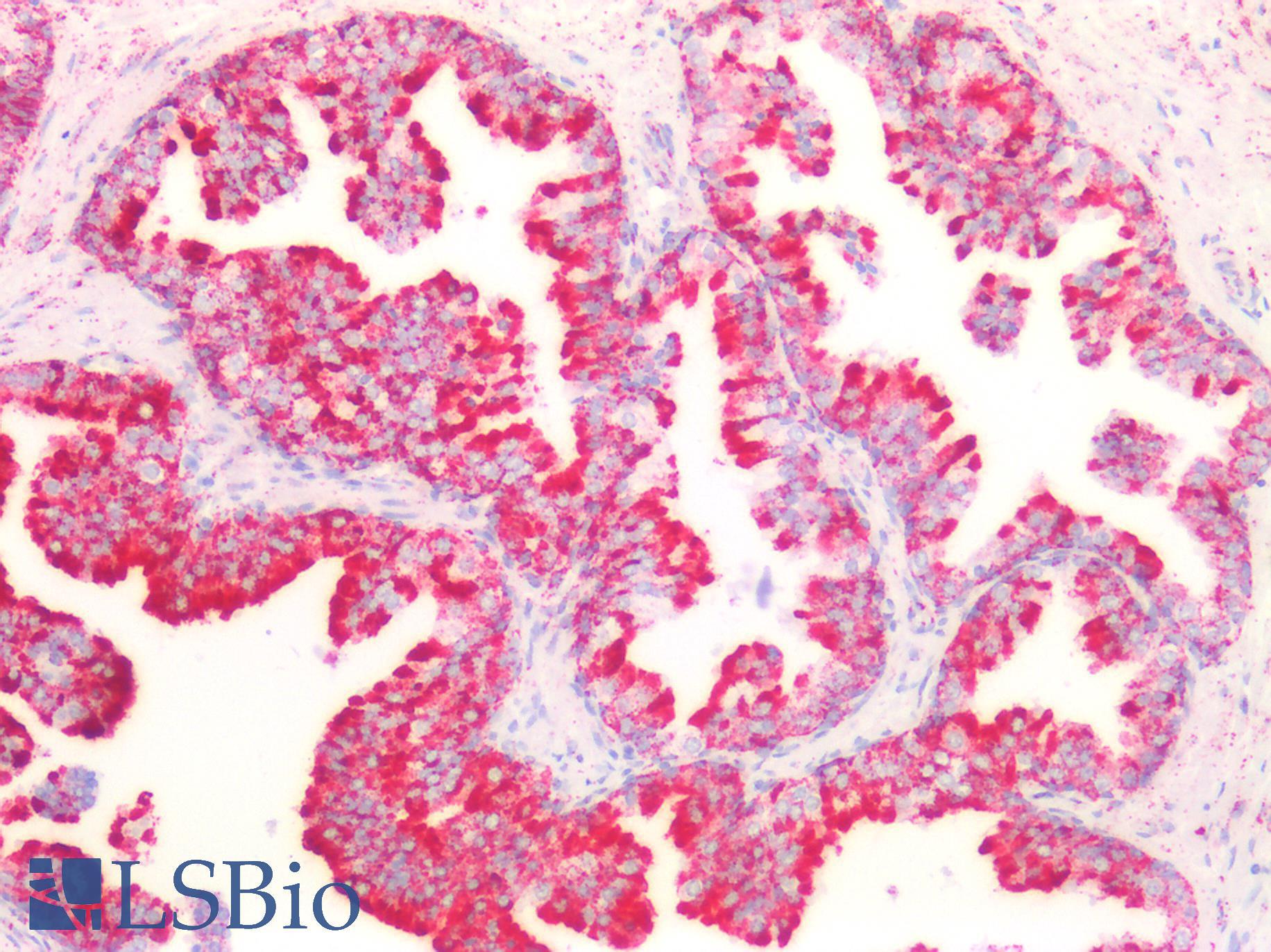PVR / CD155 Antibody - Human Prostate: Formalin-Fixed, Paraffin-Embedded (FFPE)