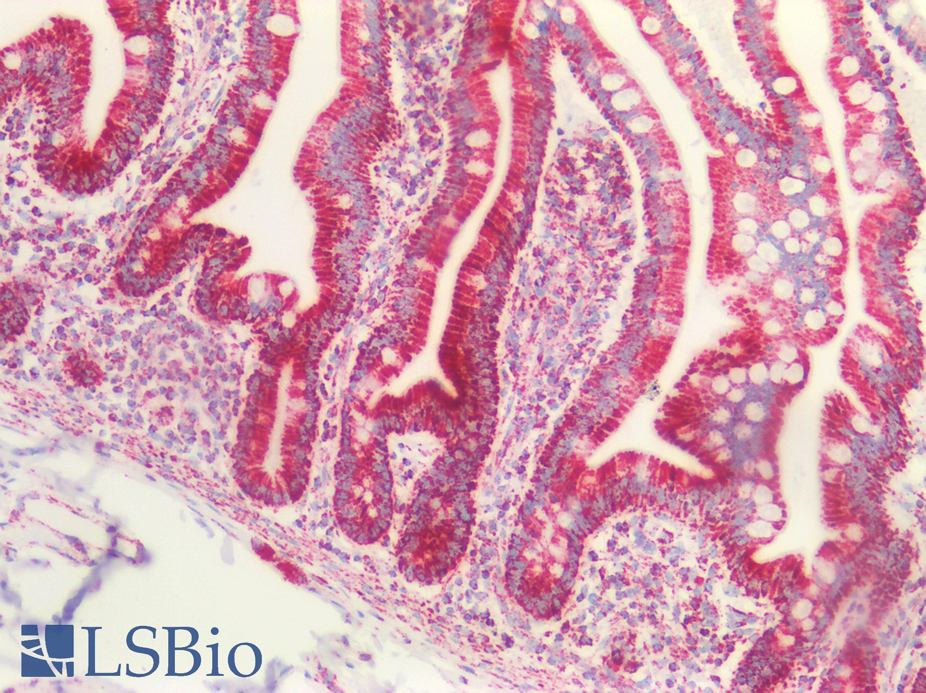 PVR / CD155 Antibody - Human Small Intestine: Formalin-Fixed, Paraffin-Embedded (FFPE)
