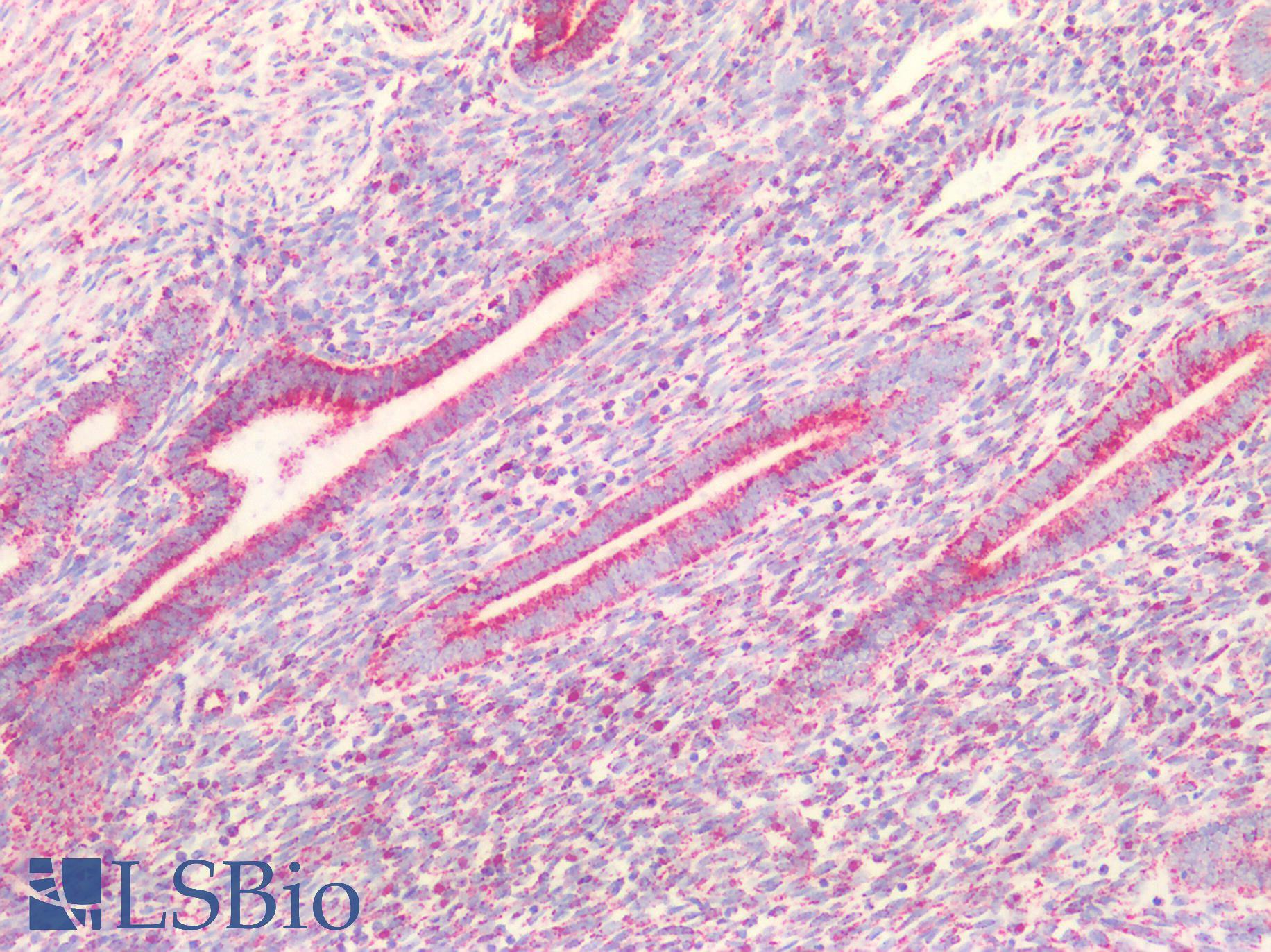 PVR / CD155 Antibody - Human Uterus: Formalin-Fixed, Paraffin-Embedded (FFPE)