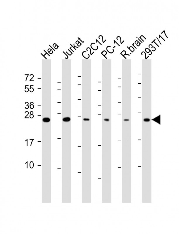 RAB11A Antibody - All lanes: Anti-RAB11A Antibody at 1:4000 dilution. Lane 1: HeLa whole cell lysate. Lane 2: Jurkat whole cell lysate. Lane 3: C2C12 whole cell lysate. Lane 4: PC-12 whole cell lysate. Lane 5: rat brain lysate. Lane 6: 293T/17 whole cell lysate Lysates/proteins at 20 ug per lane. Secondary Goat Anti-mouse IgG, (H+L), Peroxidase conjugated at 1:10000 dilution. Predicted band size: 24 kDa. Blocking/Dilution buffer: 5% NFDM/TBST.