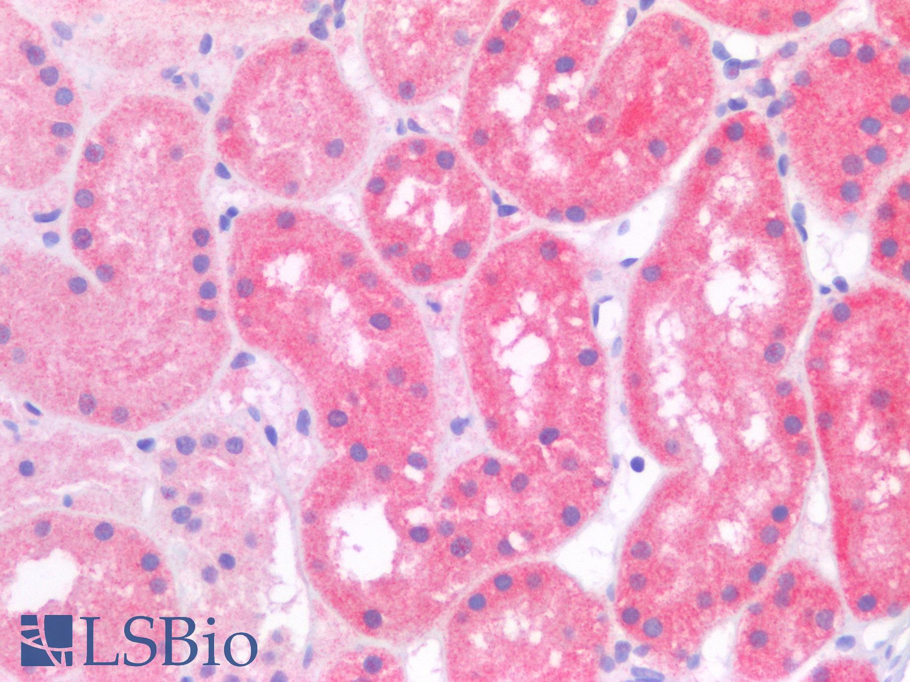 RAB11A Antibody - Human Kidney: Formalin-Fixed, Paraffin-Embedded (FFPE)