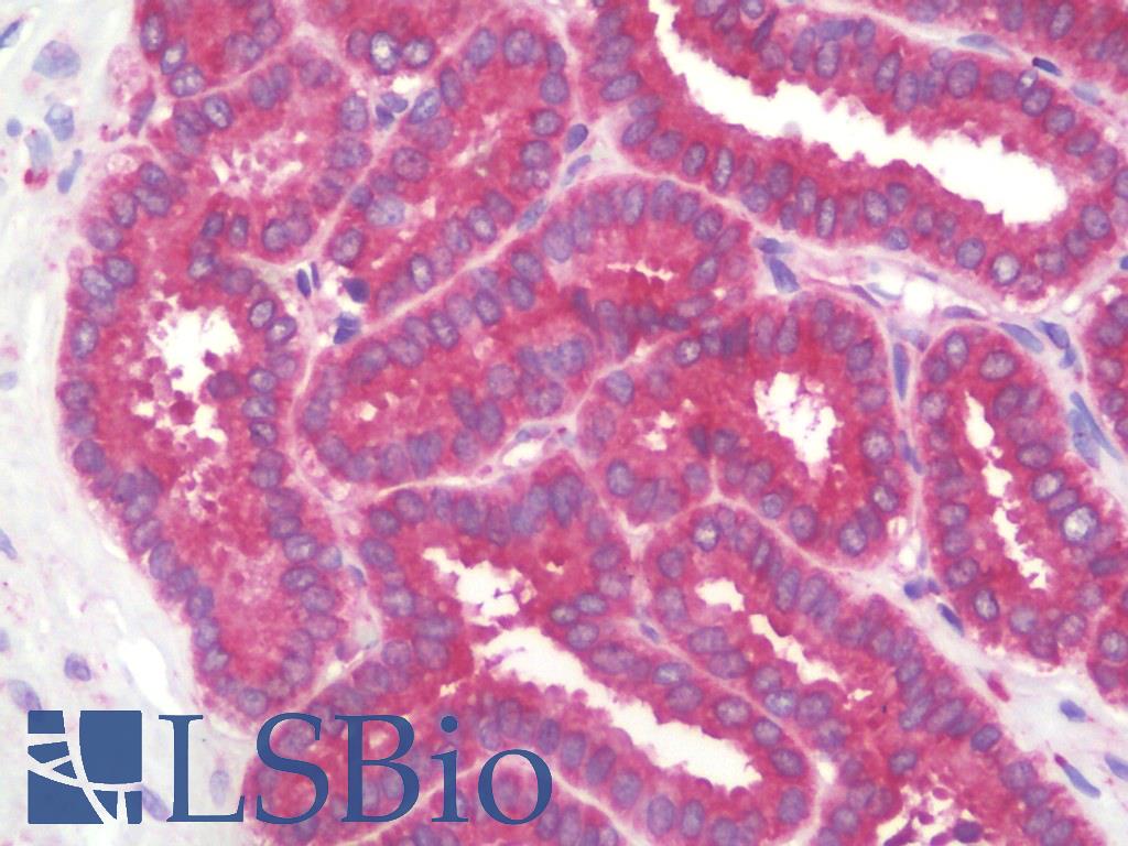 RAB5A / RAB5 Antibody - Anti-RAB5A / RAB5 antibody IHC staining of human prostate. Immunohistochemistry of formalin-fixed, paraffin-embedded tissue after heat-induced antigen retrieval.