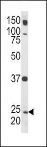 RAB5A / RAB5 Antibody - Western blot of Rab5 Antibody in HL-60 cell line lysates (35 ug/lane). RAB5 (arrow) was detected using the purified antibody.