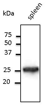 RAB5A / RAB5 Antibody - Western blot. Anti-Rab5 antibody at 1:1000 dilution. Tissue lysate at 100 ug per lane. Rabbit polyclonal to goat IgG (HRP) at 1:10000 dilution.