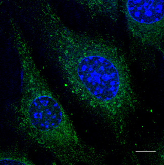 RAB5A / RAB5 Antibody - Immunofluorescence - anti-Rab5 antibody using B6-RPE07 cells at 1:50 dilution. Cells were fixed with 4% of PFA.