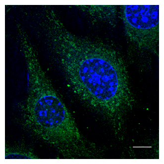 RAB5A / RAB5 Antibody - Immunofluorescence - anti-Rab5 Ab using 86-RPEO7 cells at 1:50 dilution; cells were fixed with 4% of PFA;