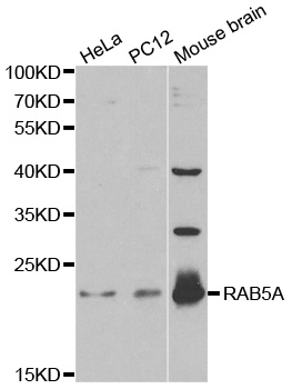 RAB5A / RAB5 Antibody - Western blot analysis of extracts of various cell lines, using RAB5A antibody at 1:1000 dilution. The secondary antibody used was an HRP Goat Anti-Rabbit IgG (H+L) at 1:10000 dilution. Lysates were loaded 25ug per lane and 3% nonfat dry milk in TBST was used for blocking.