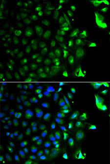 RAB5A / RAB5 Antibody - Immunofluorescence analysis of HeLa cells using RAB5A antibody. Blue: DAPI for nuclear staining.