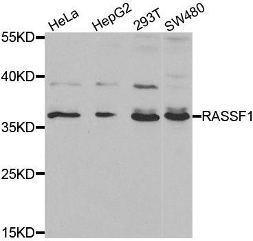 RASSF1 / RASSF1A Antibody - Western blot analysis of extracts of various cell lines, using RASSF1 antibody at 1:1000 dilution. The secondary antibody used was an HRP Goat Anti-Rabbit IgG (H+L) at 1:10000 dilution. Lysates were loaded 25ug per lane and 3% nonfat dry milk in TBST was used for blocking.