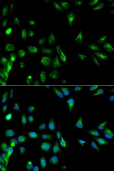 RASSF1 / RASSF1A Antibody - Immunofluorescence analysis of HeLa cells using RASSF1 antibody. Blue: DAPI for nuclear staining.