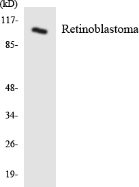 RB1 / Retinoblastoma / RB Antibody - Western blot analysis of the lysates from COLO205 cells using Retinoblastoma antibody.