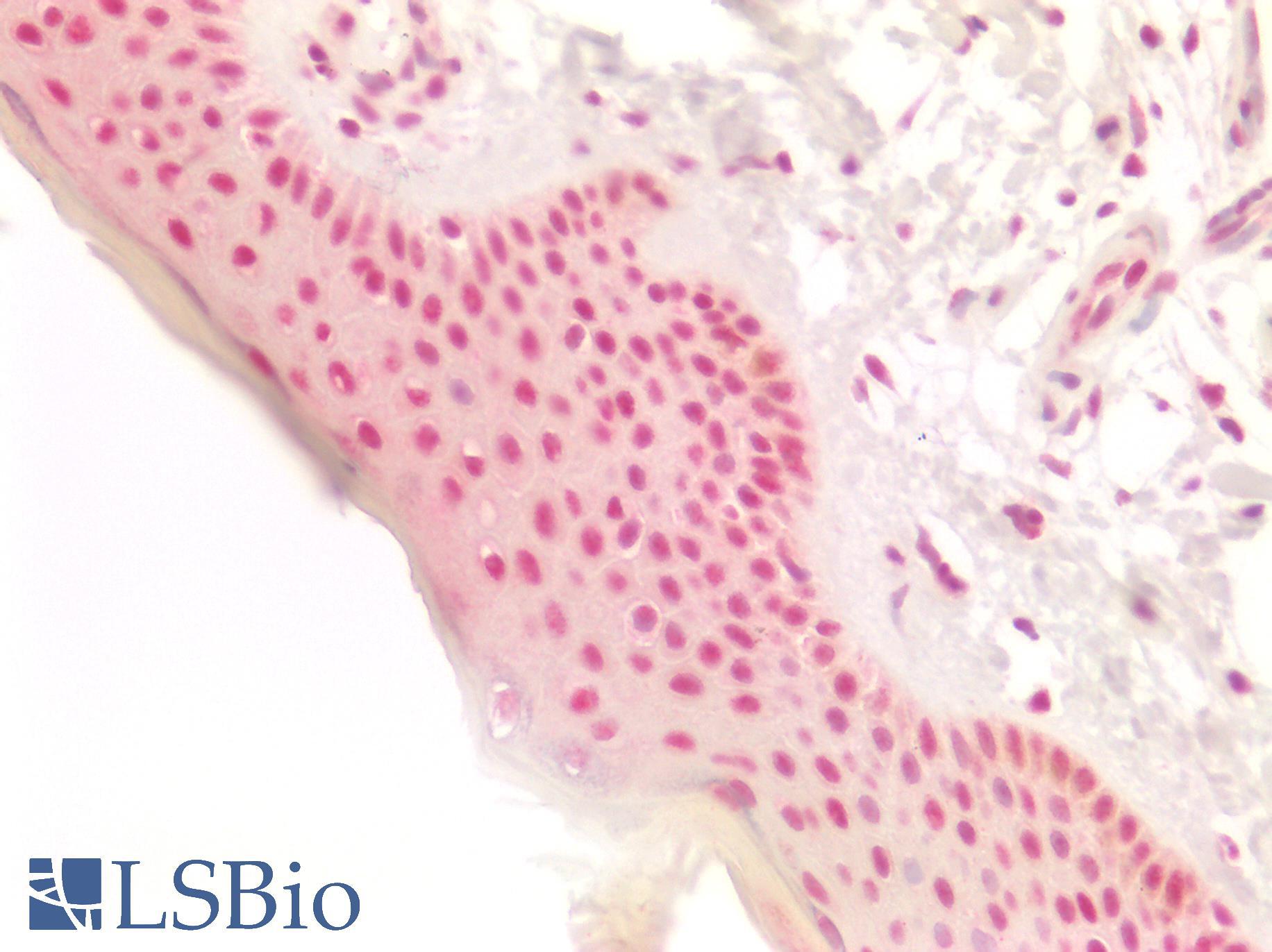RB1 / Retinoblastoma / RB Antibody - Human Skin: Formalin-Fixed, Paraffin-Embedded (FFPE)
