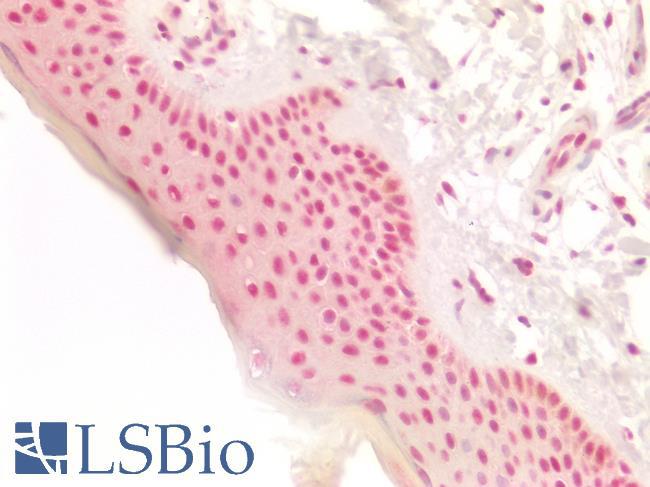 RB1 / Retinoblastoma / RB Antibody - Human Skin: Formalin-Fixed, Paraffin-Embedded (FFPE)