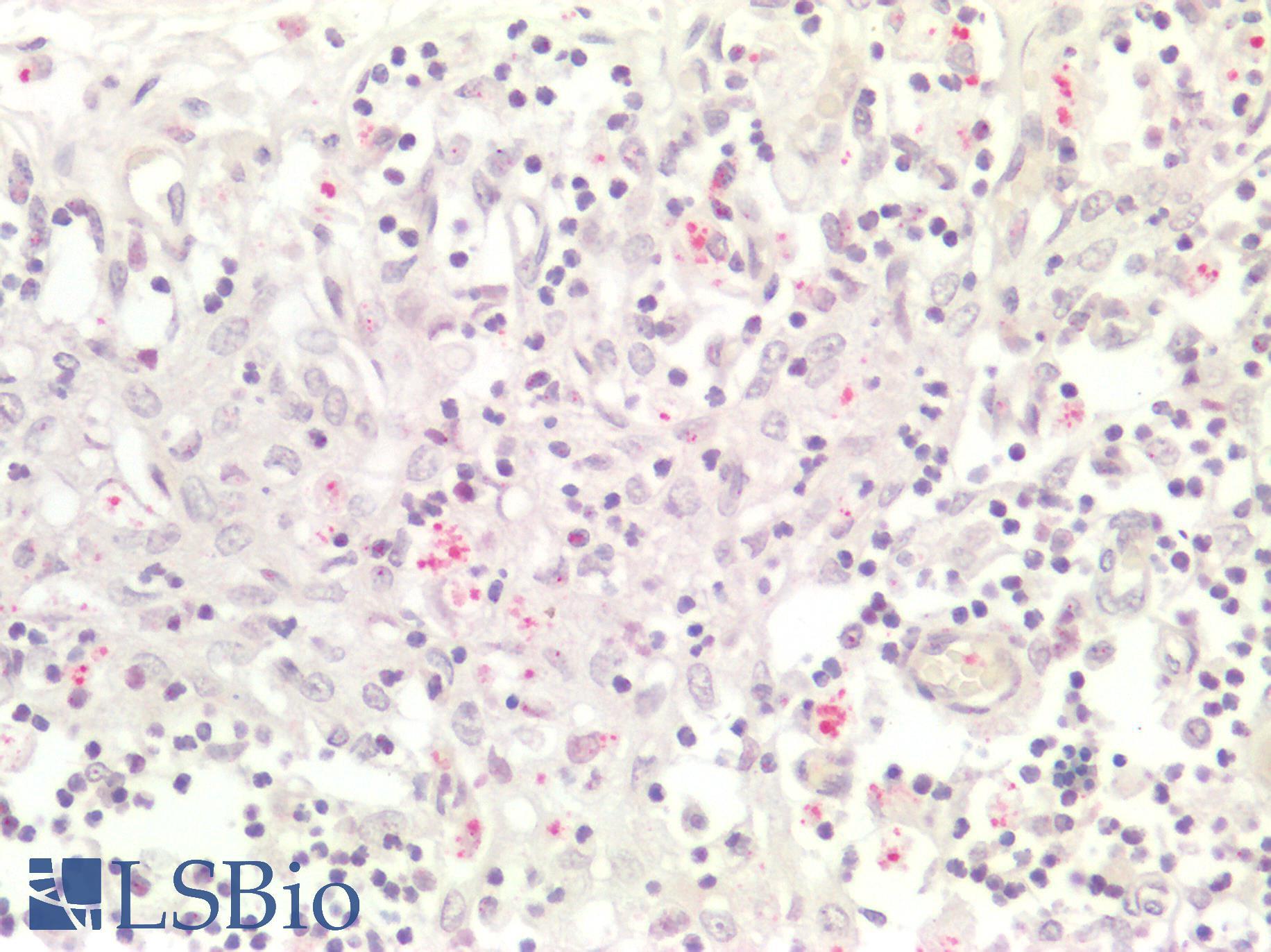 RB1 / Retinoblastoma / RB Antibody - Human Spleen: Formalin-Fixed, Paraffin-Embedded (FFPE)