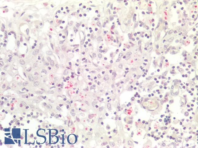 RB1 / Retinoblastoma / RB Antibody - Human Spleen: Formalin-Fixed, Paraffin-Embedded (FFPE)