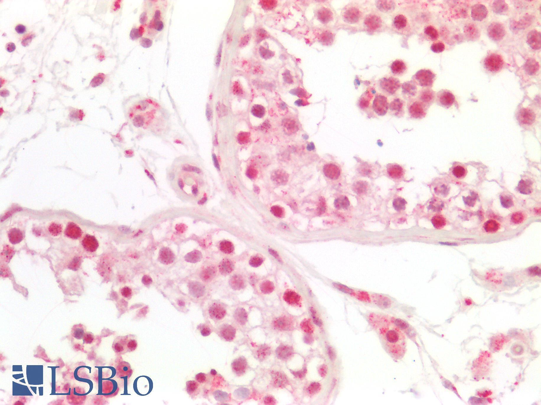 RB1 / Retinoblastoma / RB Antibody - Human Testis: Formalin-Fixed, Paraffin-Embedded (FFPE)