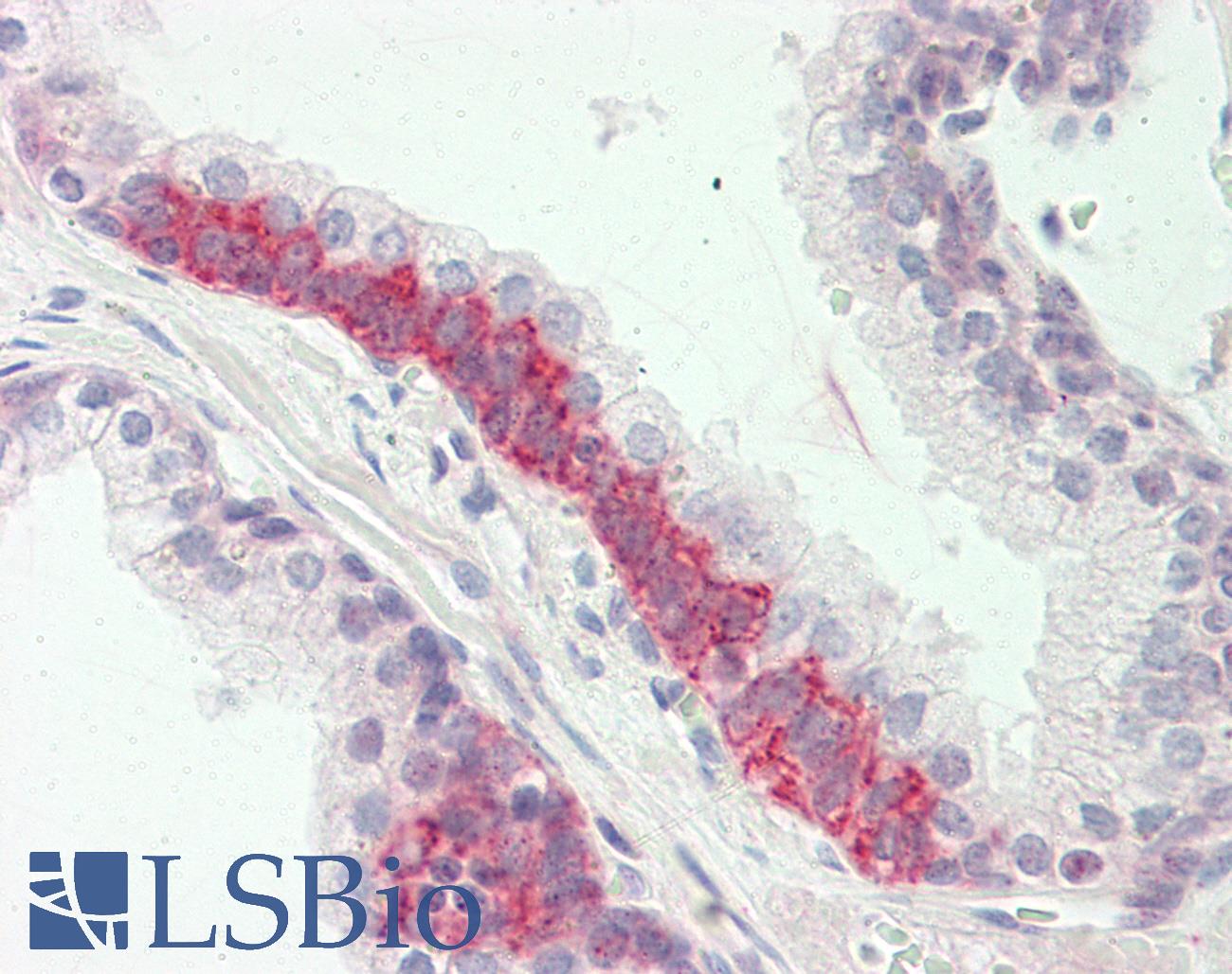 RBFOX3 / NEUN Antibody - Anti-RBFOX3 / NEUN antibody IHC staining of human prostate. Immunohistochemistry of formalin-fixed, paraffin-embedded tissue after heat-induced antigen retrieval.  This image was taken for the unconjugated form of this product. Other forms have not been tested.