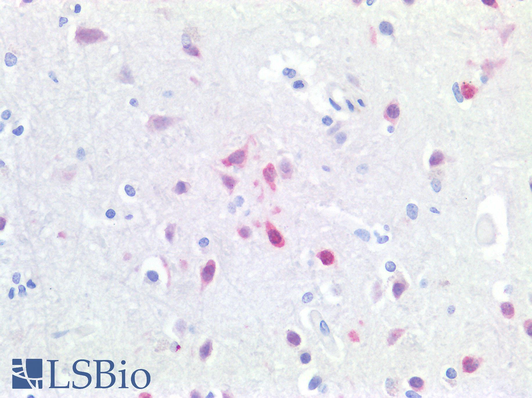 RBFOX3 / NEUN Antibody - Human Brain, Cortex: Formalin-Fixed, Paraffin-Embedded (FFPE)
