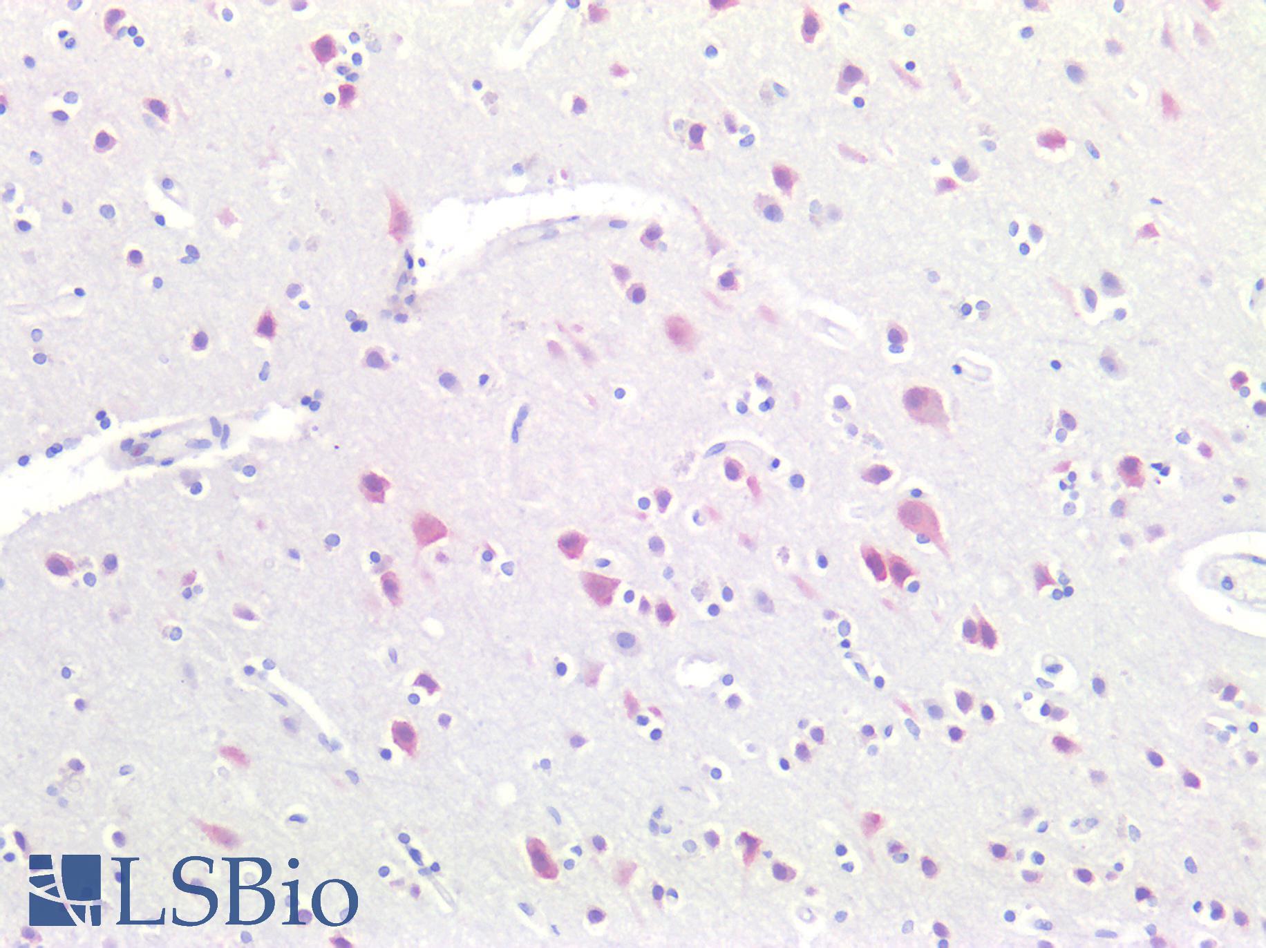 RBFOX3 / NEUN Antibody - Human Brain, Cortex: Formalin-Fixed, Paraffin-Embedded (FFPE)