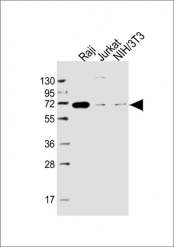 RELB Antibody - All lanes: Anti-RELB Antibody at 1:5000 dilution Lane 1: Raji whole cell lysate Lane 2: Jurkat whole cell lysate Lane 3: NIH/3T3 whole cell lysate Lysates/proteins at 20 µg per lane. Secondary Goat Anti-mouse IgG, (H+L), Peroxidase conjugated at 1/10000 dilution. Predicted band size: 62 kDa Blocking/Dilution buffer: 5% NFDM/TBST.