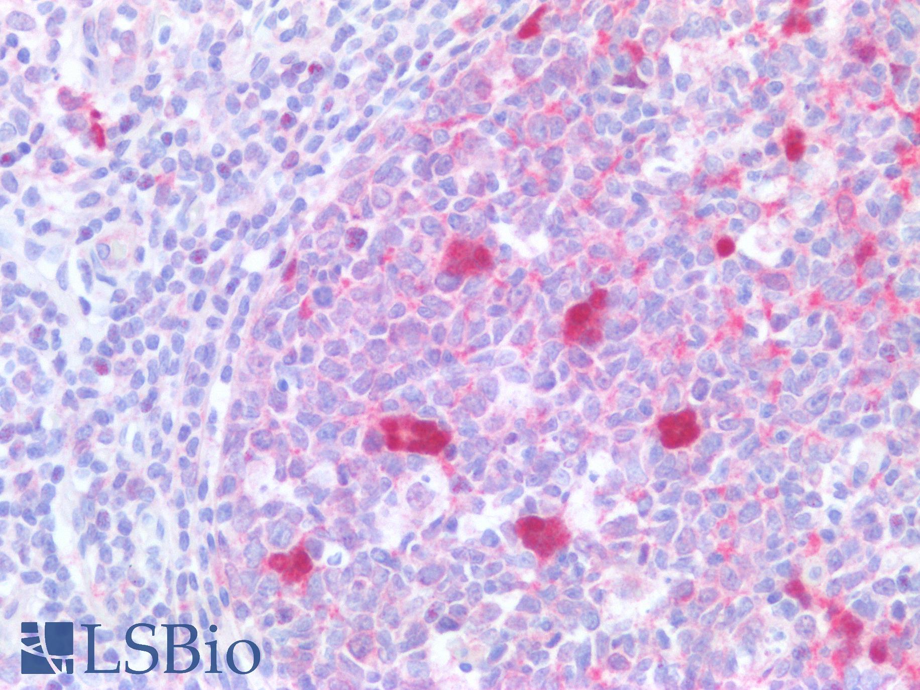 RELB Antibody - Human Tonsil: Formalin-Fixed, Paraffin-Embedded (FFPE)