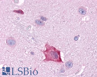 RORA / ROR Alpha Antibody - Brain, Basal Ganglia
