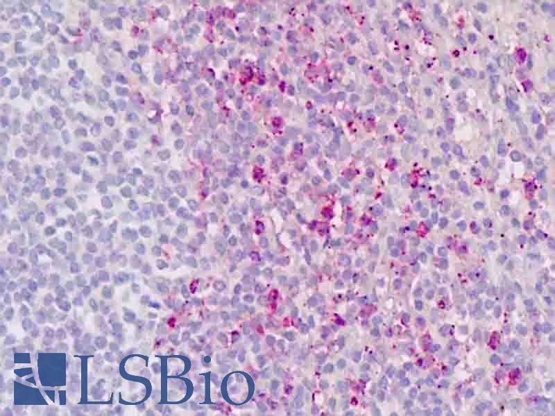 RORC / ROR Gamma Antibody - Human Spleen: Formalin-Fixed, Paraffin-Embedded (FFPE)