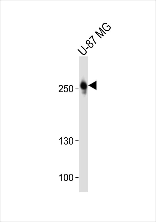 ROS1 / ROS Antibody - Western blot of lysate from U-87 MG cell line with ROS1 Antibody. Antibody was diluted at 1:1000. A goat anti-rabbit IgG H&L (HRP) at 1:10000 dilution was used as the secondary antibody. Lysate at 20 ug.