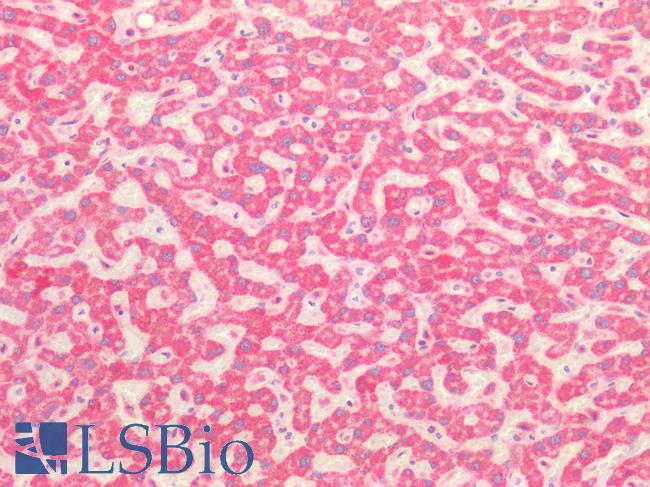 ROS1 / ROS Antibody - Human Liver: Formalin-Fixed, Paraffin-Embedded (FFPE)