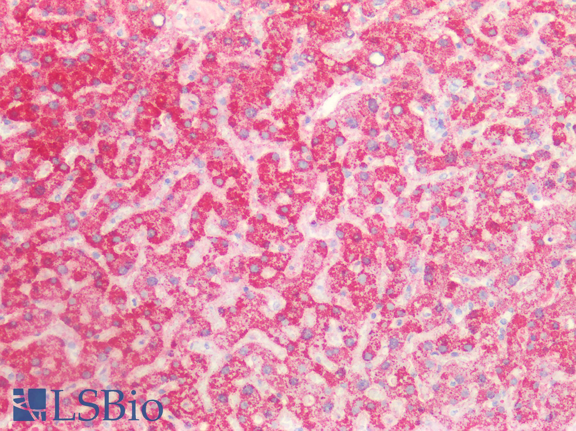 ROS1 / ROS Antibody - Human Liver: Formalin-Fixed, Paraffin-Embedded (FFPE)