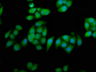 RPE65 Antibody - Immunofluorescence staining of Hela cells at a dilution of 1:233, counter-stained with DAPI. The cells were fixed in 4% formaldehyde, permeabilized using 0.2% Triton X-100 and blocked in 10% normal Goat Serum. The cells were then incubated with the antibody overnight at 4 °C.The secondary antibody was Alexa Fluor 488-congugated AffiniPure Goat Anti-Rabbit IgG (H+L) .